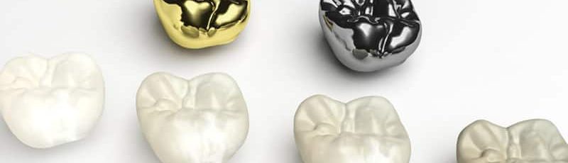 dental crowns in ne calgary
