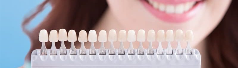 dental veneers in ne calgary
