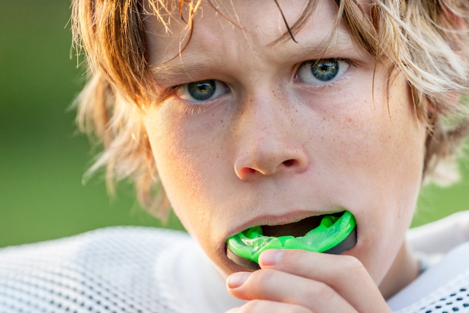 mouthguards are essential athletic equipment
