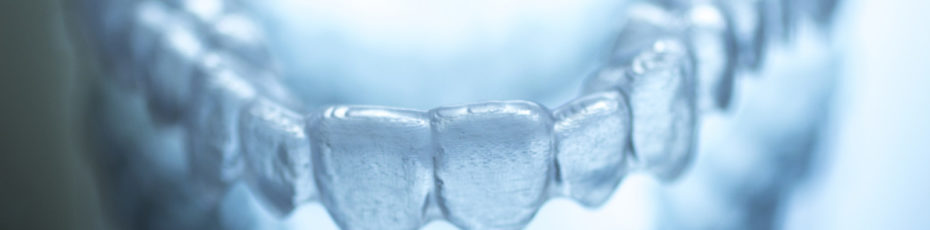 things to know about invisalign