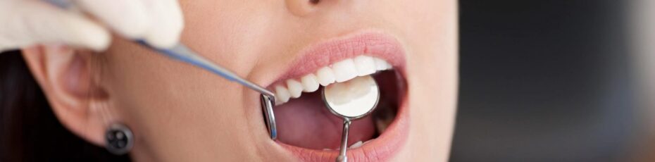 prepare for your wisdom teeth extraction as a patient