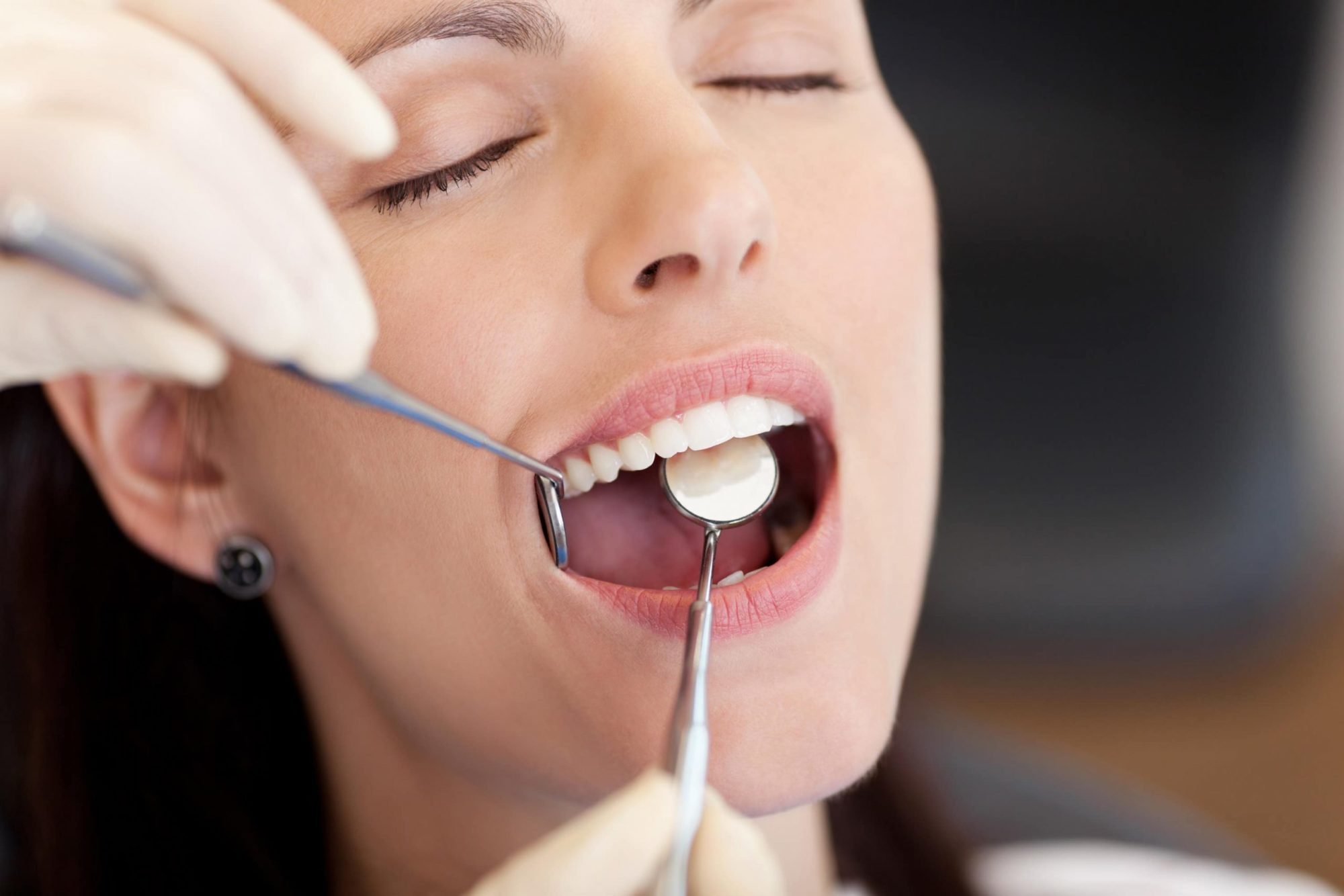 prepare for your wisdom teeth extraction as a patient