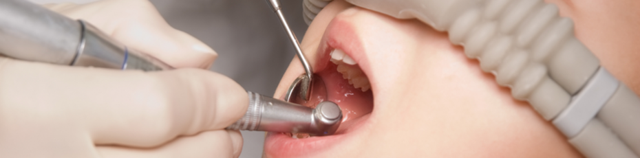 what are the benefit of sedation dentistry