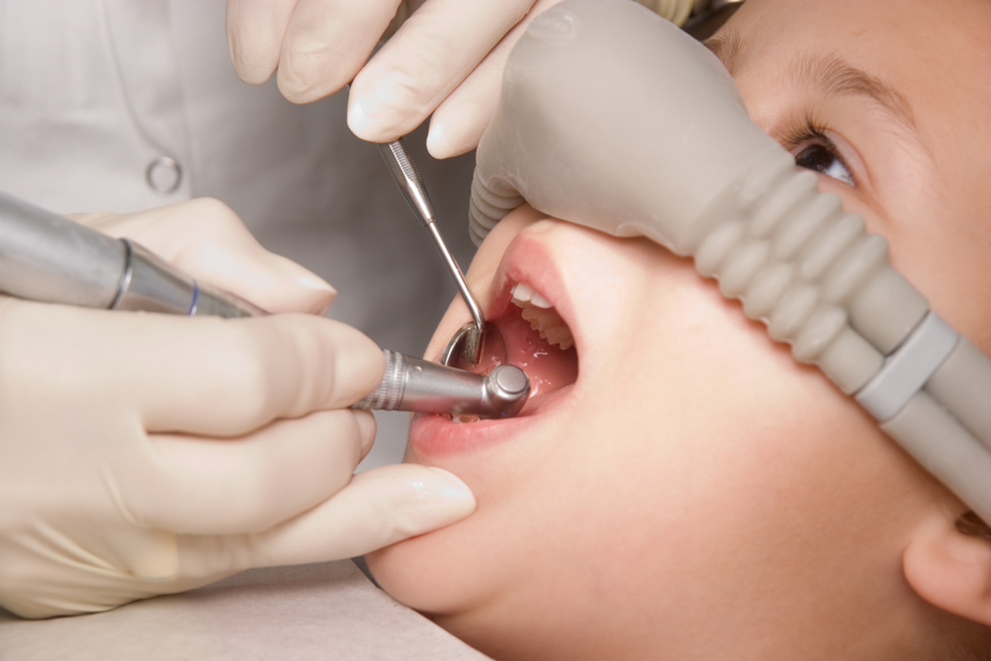 what are the benefit of sedation dentistry