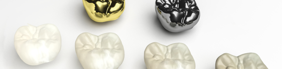 dental crown types how do i choose the right material