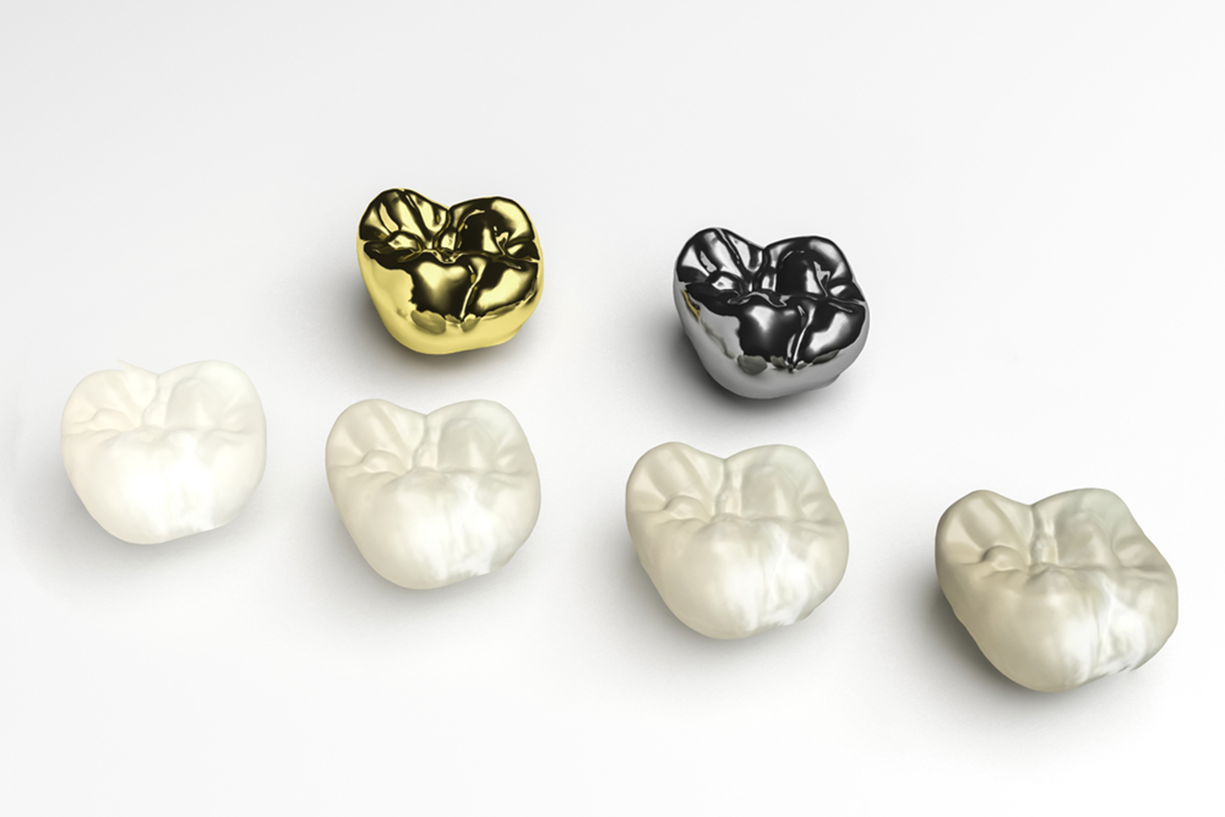 dental crown types how do i choose the right material