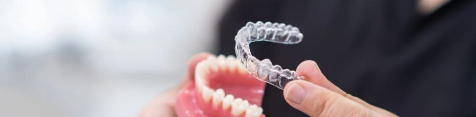 Invisalign clear aligners