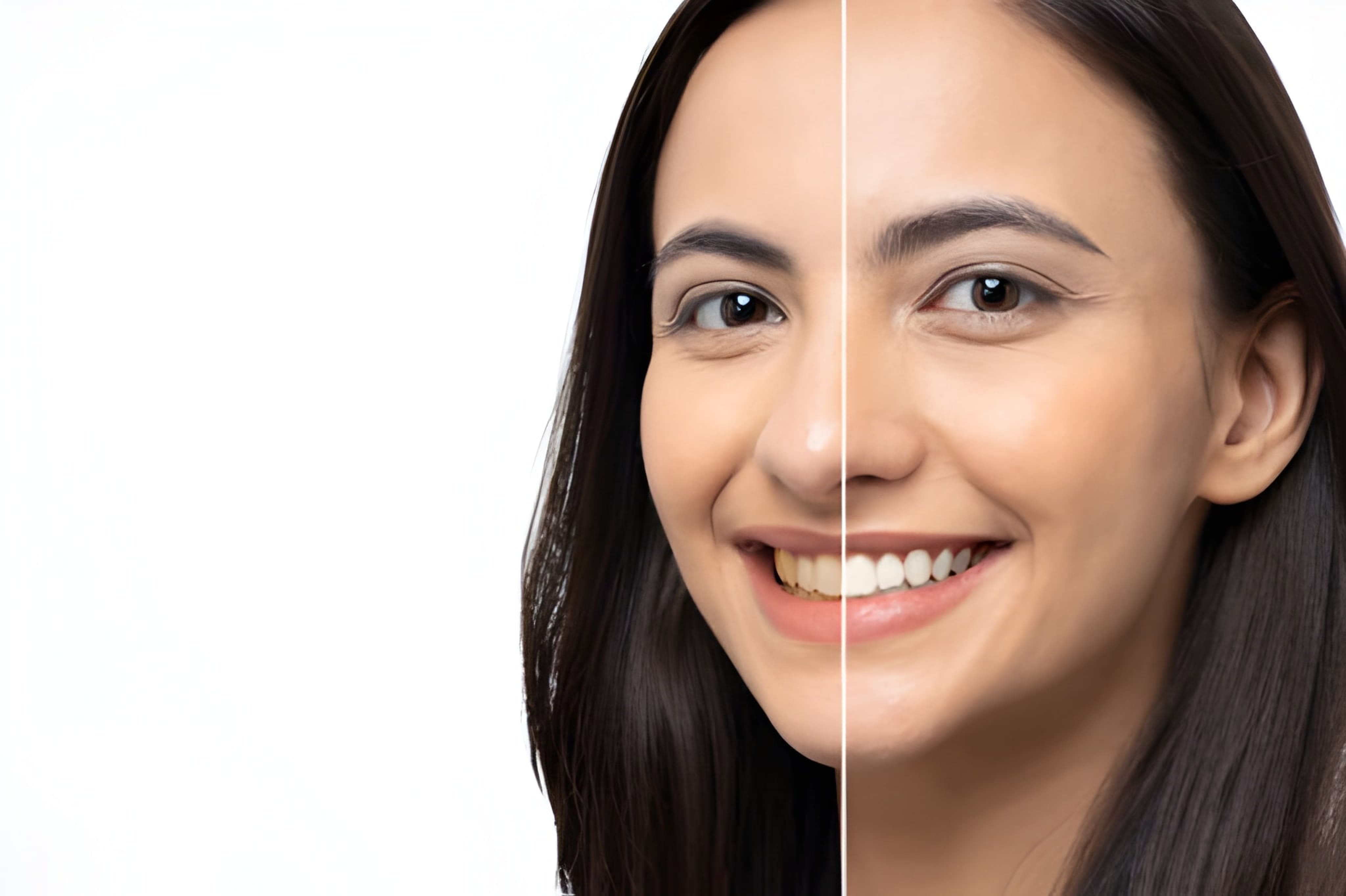 Teeth Whitening in NE Calgary