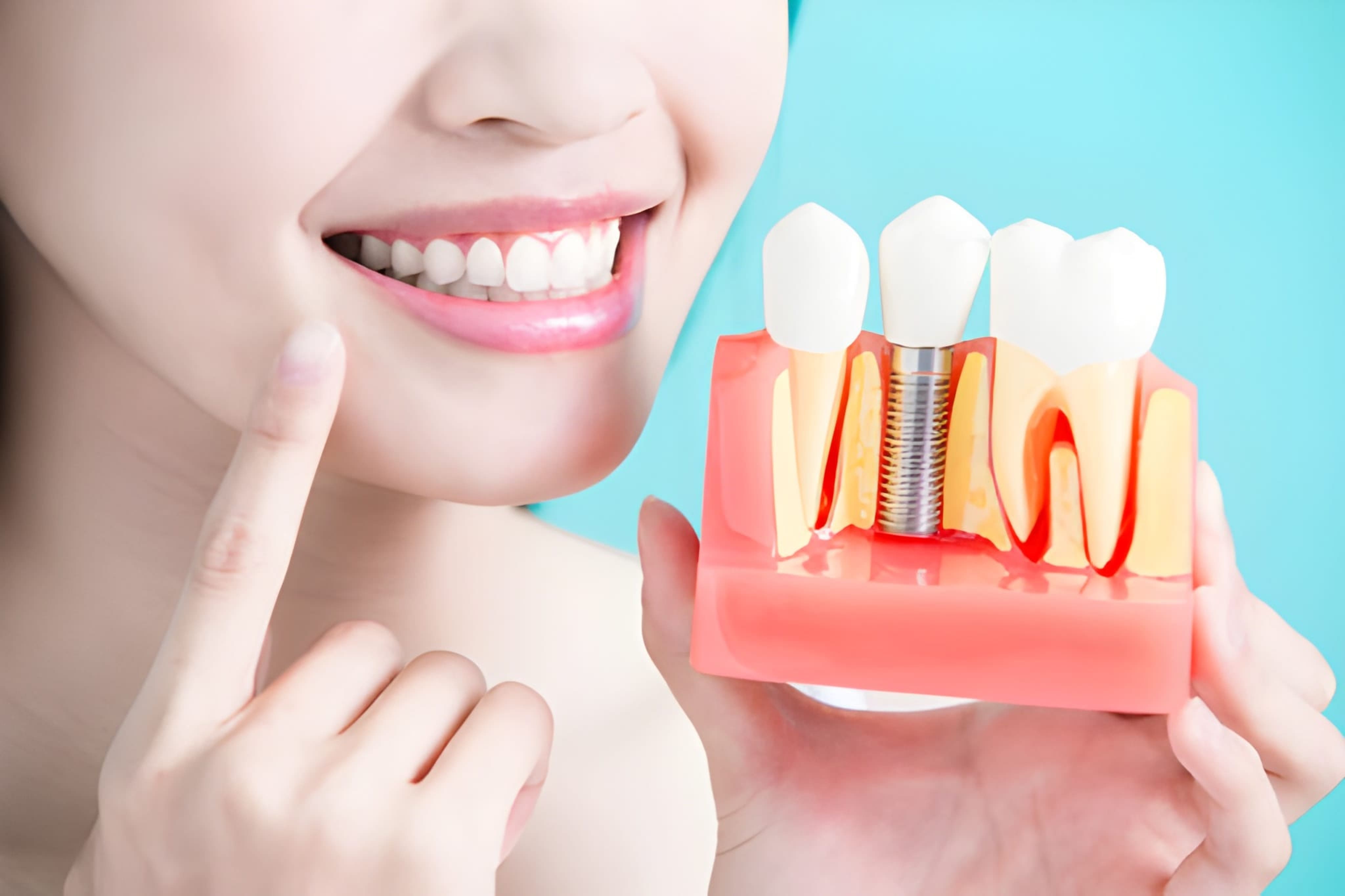 Dental Implants in NE Calgary