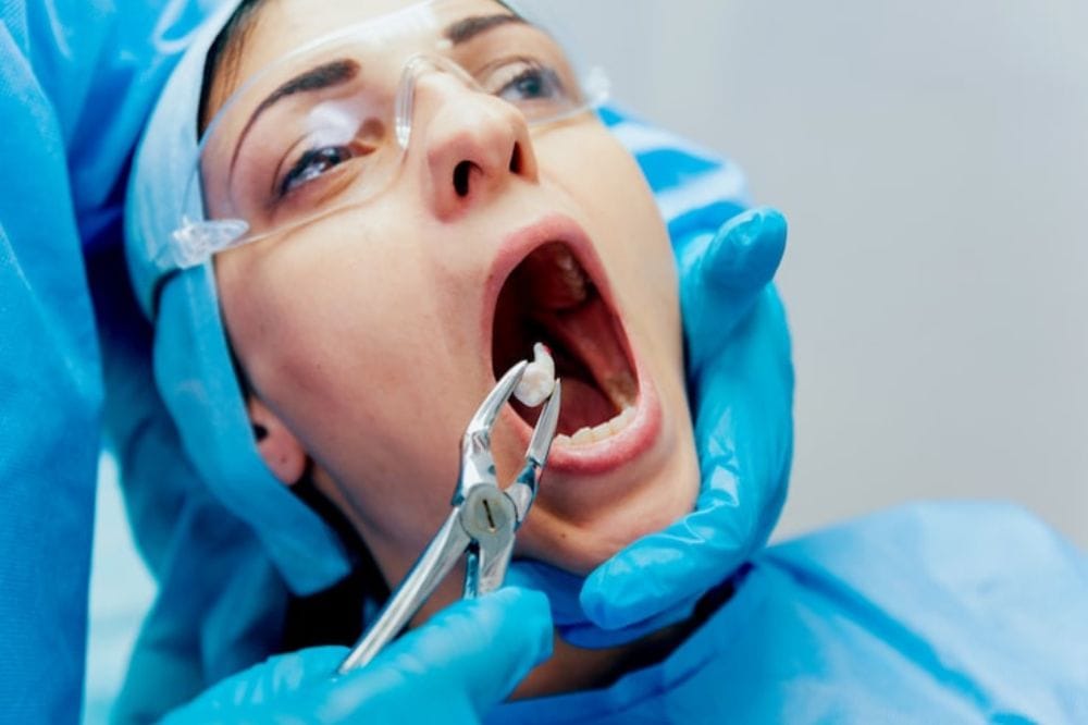 Complete Guide to Tooth Extraction: What to Expect Before and After Treatment